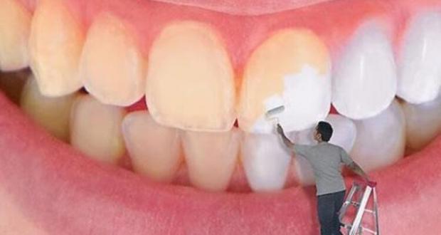 طرق علاج اصفرار الأسنان وتنظيفها بوصفات طبيعية