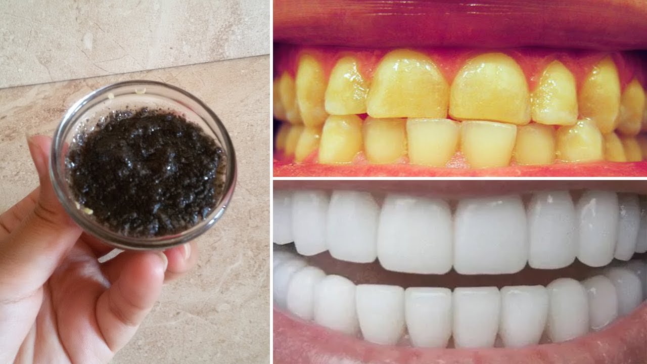 طريقة سحرية لتبييض الأسنان