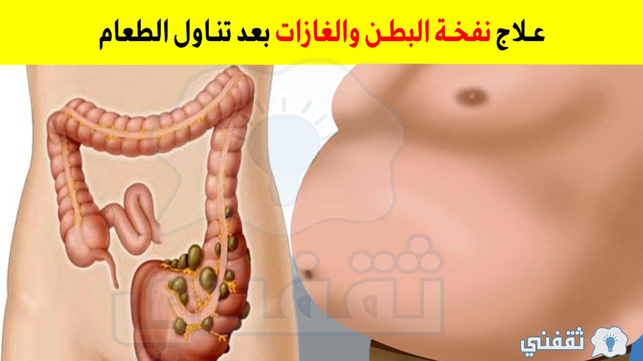 علاج انتفاخ البطن