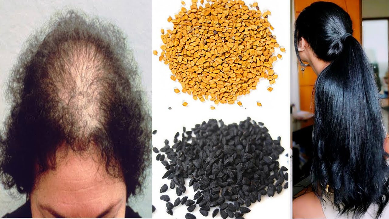 وصفة طبيعية لإعادة إنبات الشعر