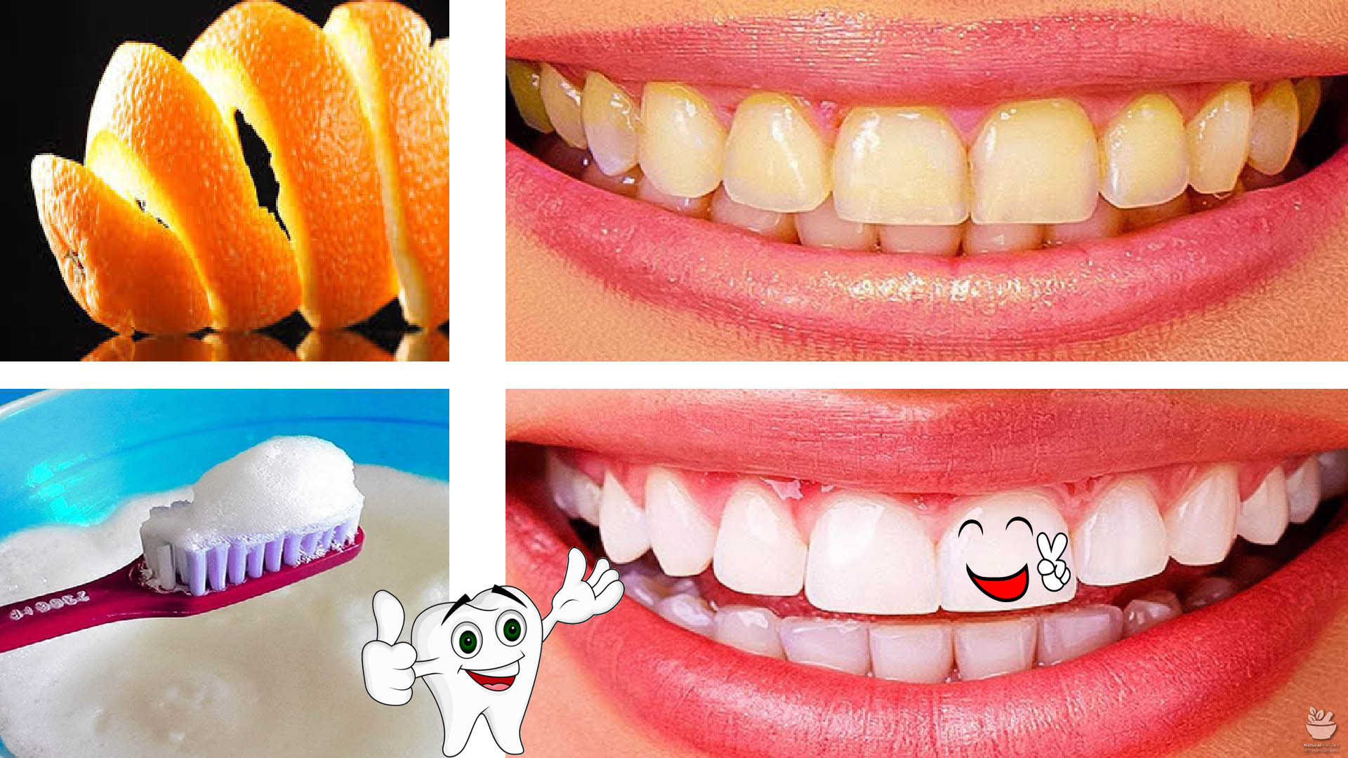 لصفوف اللولى.. تبييض الأسنان بسرعة في البيت بطرق طبيعية وفعالة من اول استخدام