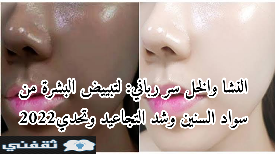 النشا والخل سر رباني