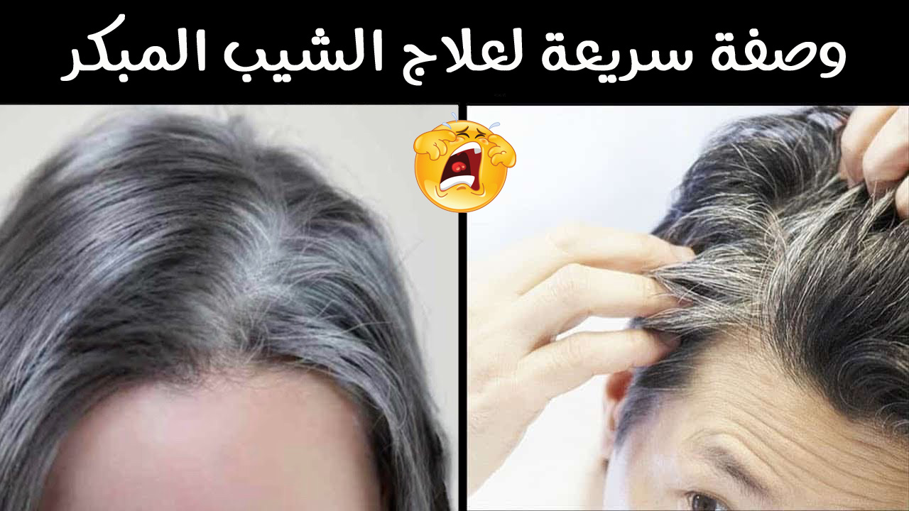 وصفة سريعة لعلاج الشيب