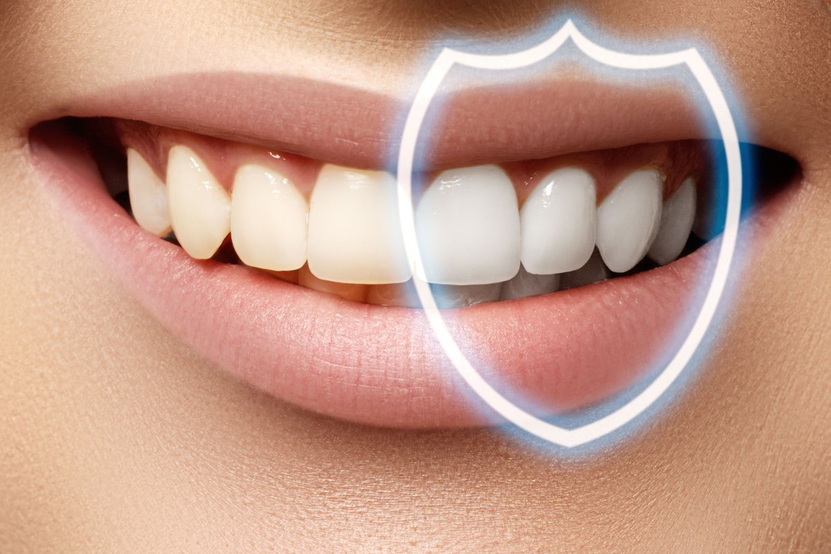 أسرع وأسهل طريقة لتبيض الأسنان والتخلص من التسوس وخير الأسنان نتيجة روعه من أول أستخدام