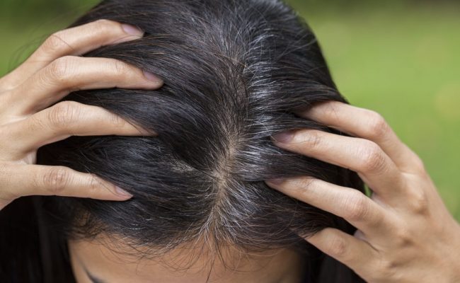 معجزة الملح لعلاج شيب الشعر نهائيا وللابد في أقل من ساعة بدون رجوعة م