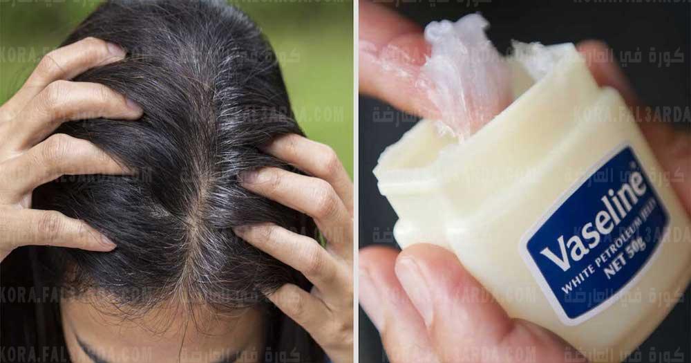 معجزة الفازلين لعلاج شيب الشعر المبكر نهائيا وللابد في أقل من ساعة بدون اي مواد كيميائية