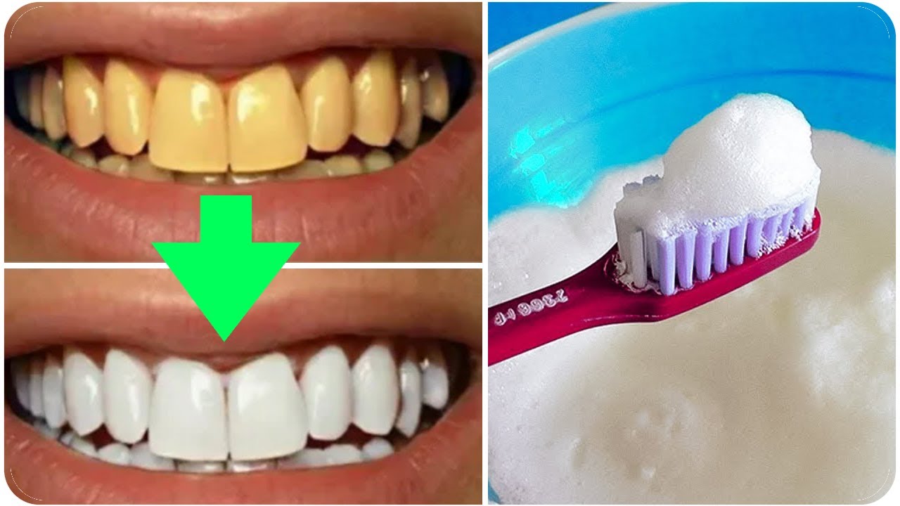 طرق استخدام البيكنج بودر للأسنان