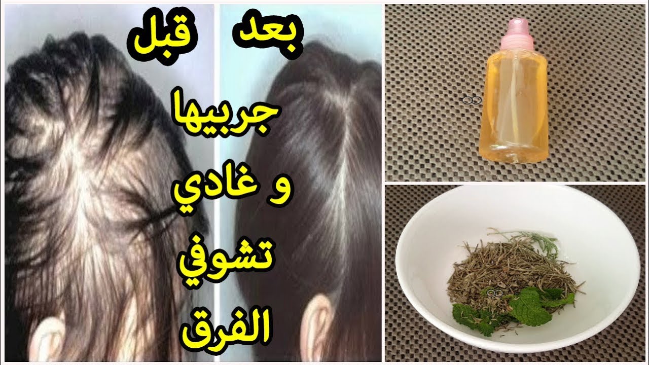 طريقة عمل بخاخ لعلاج فراغات الشعر