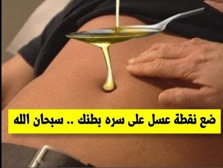 معجزة العسل على السرة...ضعي نقطة واحدة من العسل على السرة يويماً وشاهدى ماذا يحدث معجزة ربانية سبحان الله