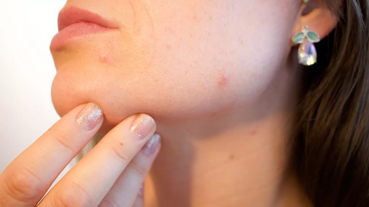 احذر ازالة شعر الوجه بهذه الطريقة قد تسبب حساسية وظهور الطفح الجلدي