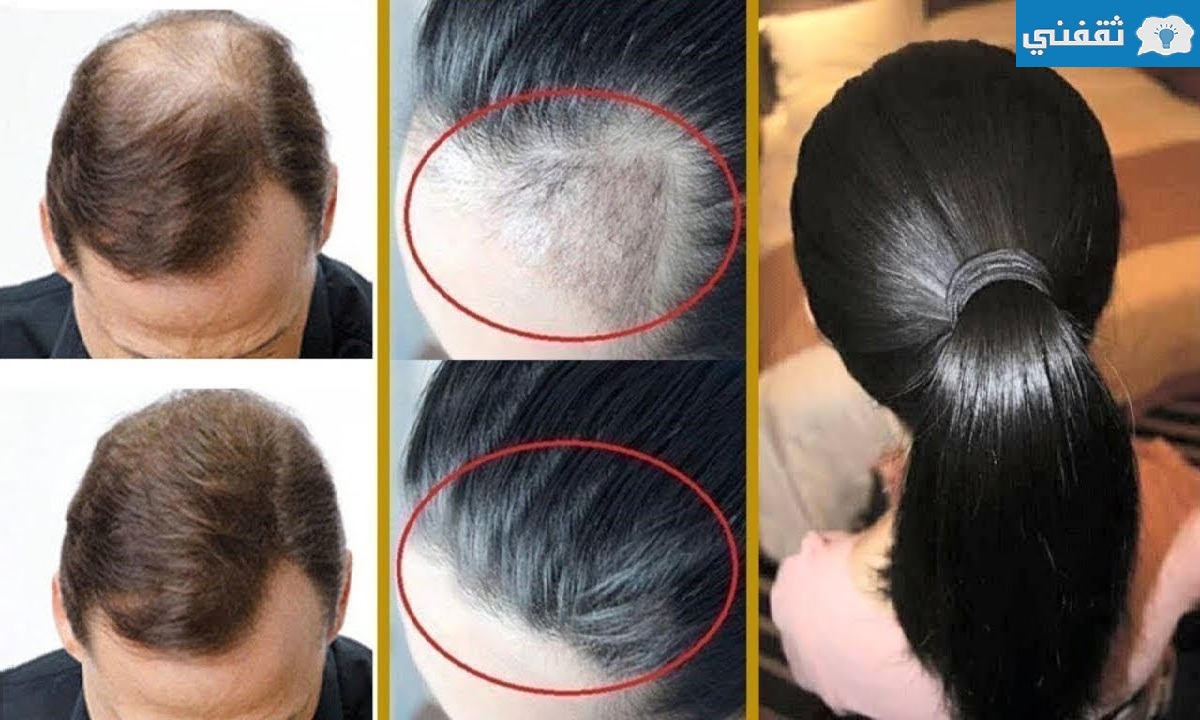 وصفة يابانية طبيعية مذهلة لتكثيف وتطويل الشعر
