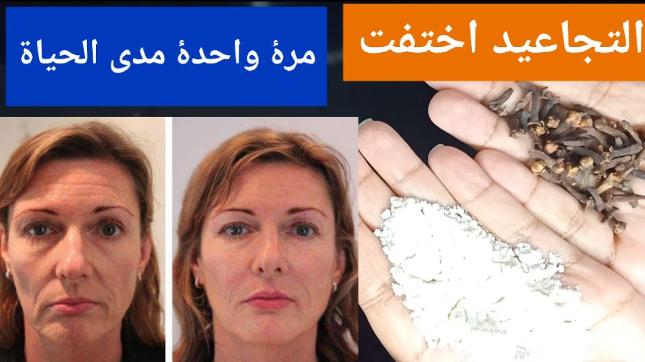 بوتكس طبيعي.. اخلطي الفازلين مع القرنفل لتبدين أصغر من سنك 10 سنوات وخالية من اي بقع أو تصبغات