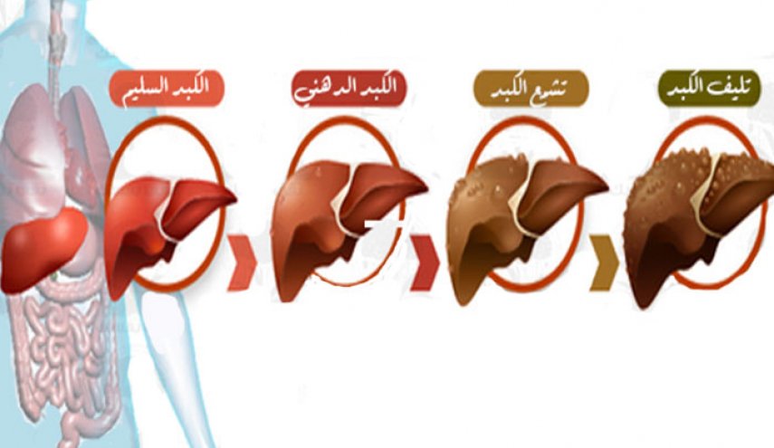 أعراض وجود مشاكل في الكبد