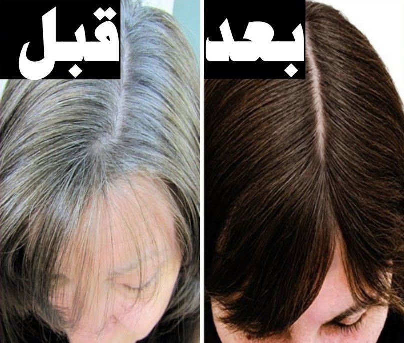 خلطات طبيعية لعلاج الشيب والتخلص من الشعر الأبيض