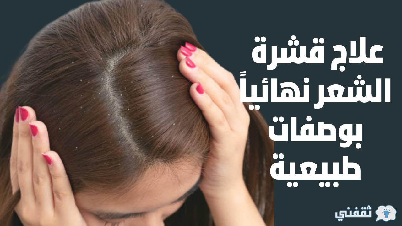 علاج قشرة الشعر للبنات