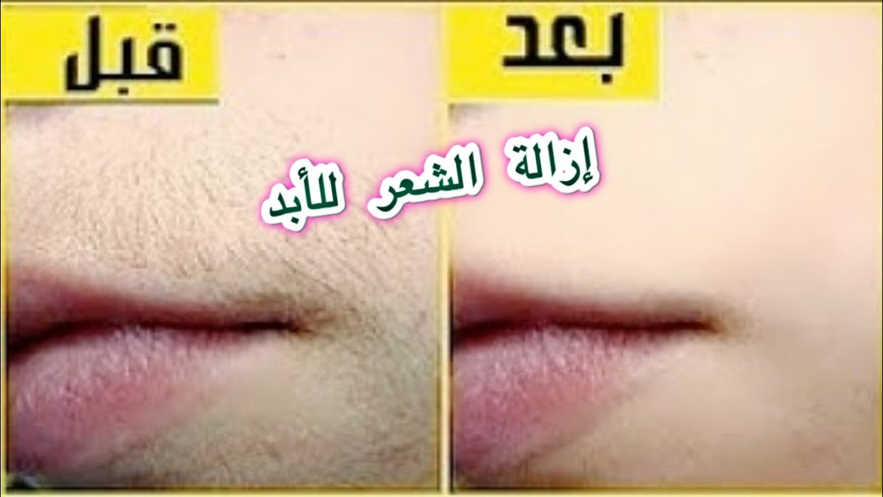 وصفة الملح الإنجليزي لإزالة شعر الوجه