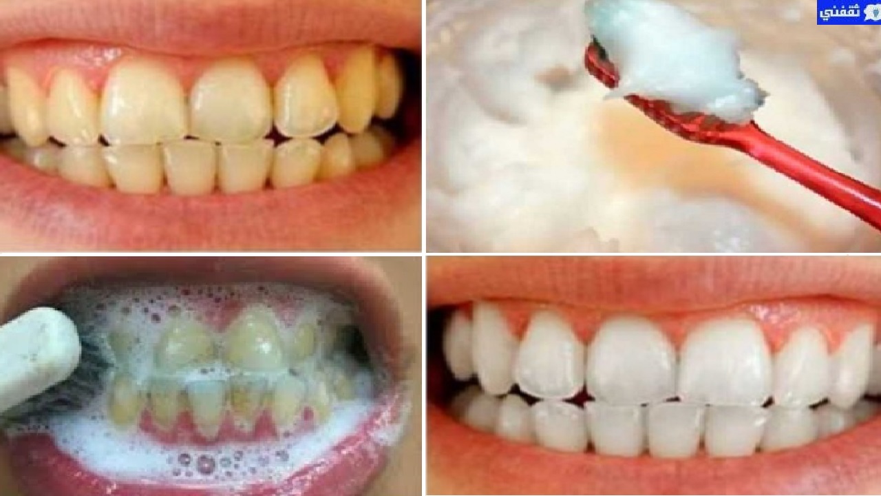 طريقة بسيطة لتبييض الأسنان والتخلص من البقع والجير من أول غسلة