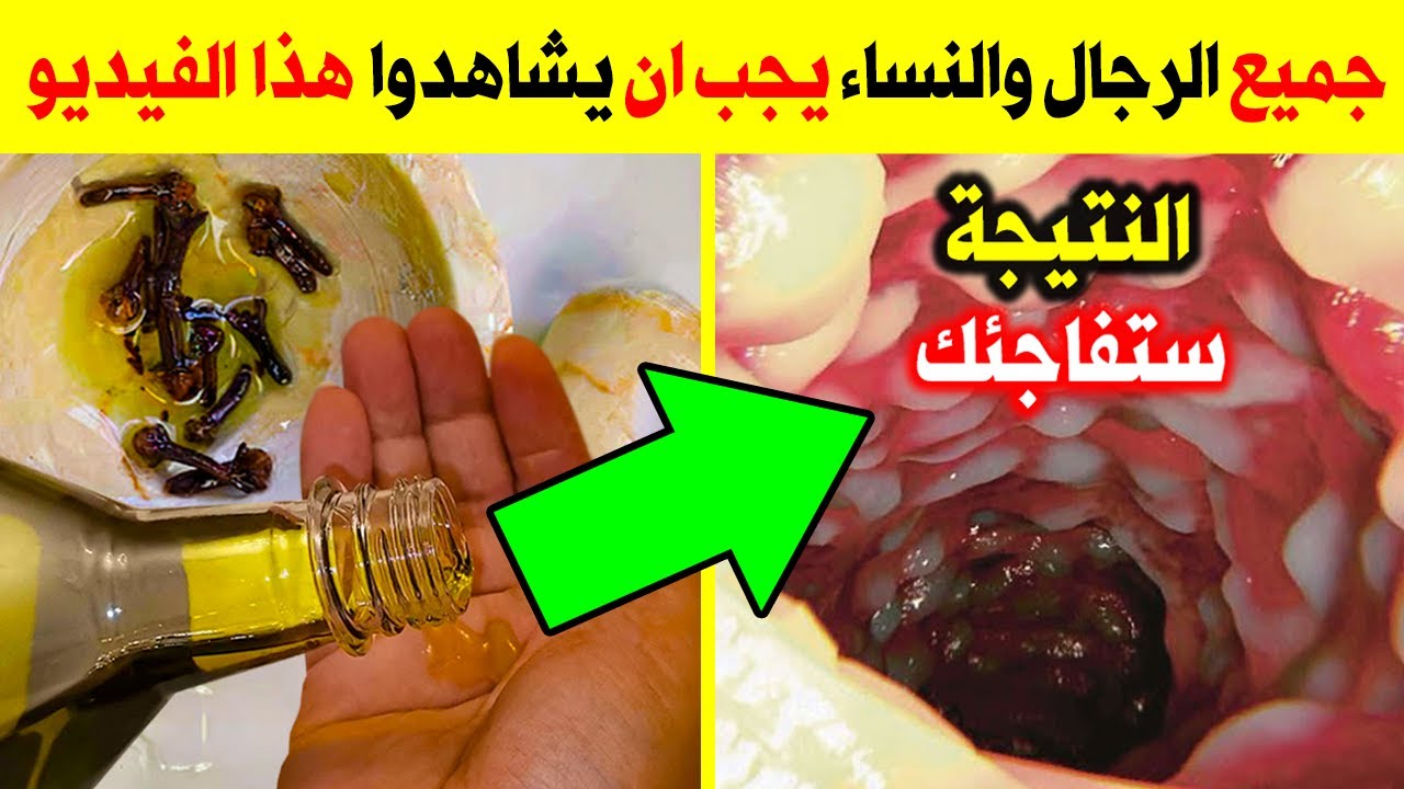 أخلطي القرنفل مع زيت الزيتون ولن تصدقي ماذا يحدث