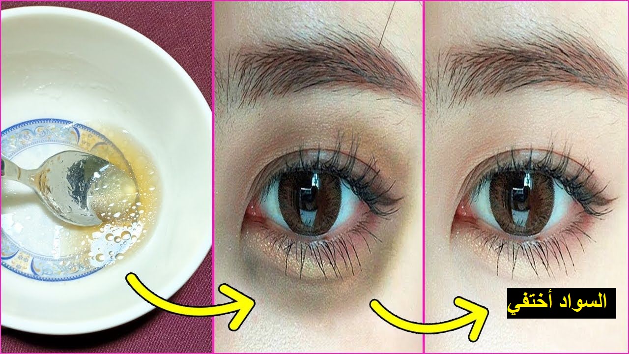 coffee to treat dark circles