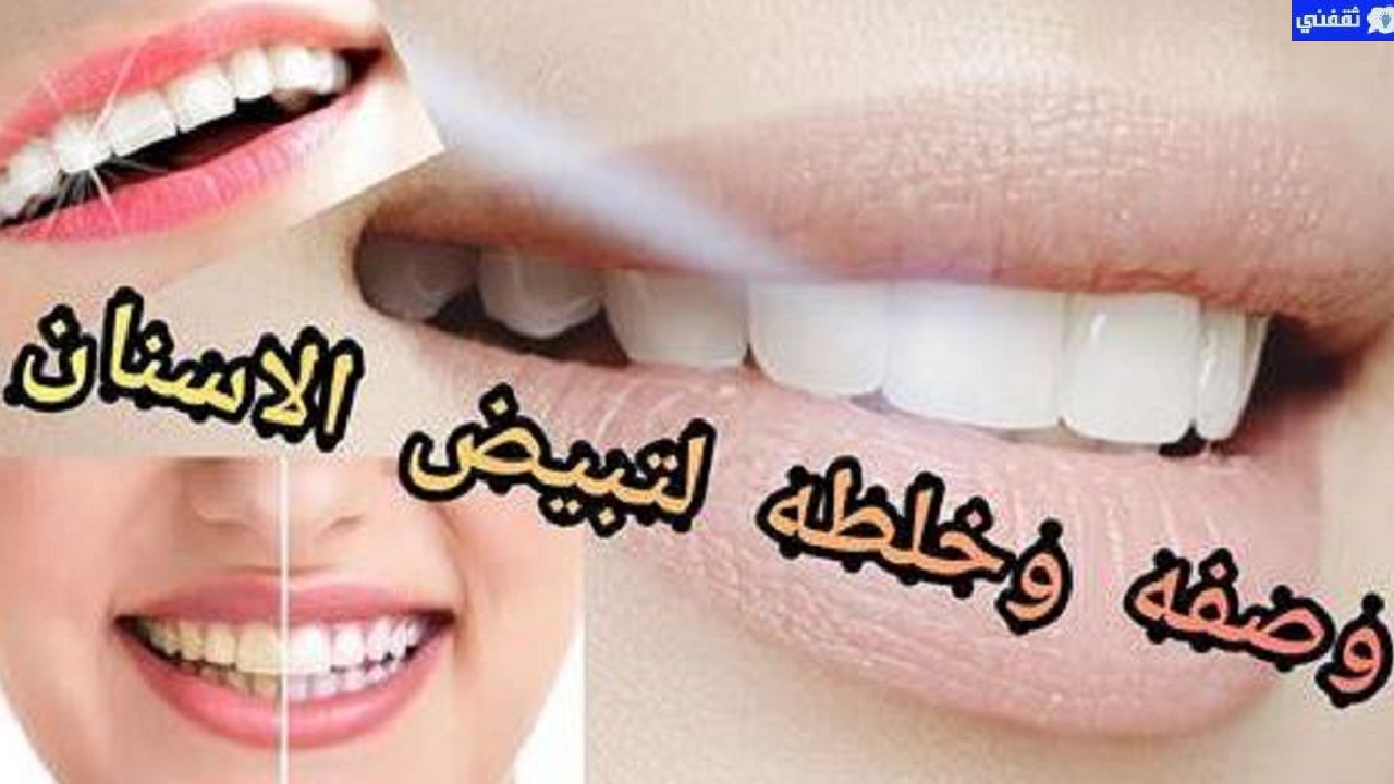 خلطة رائعة لتبييض الأسنان