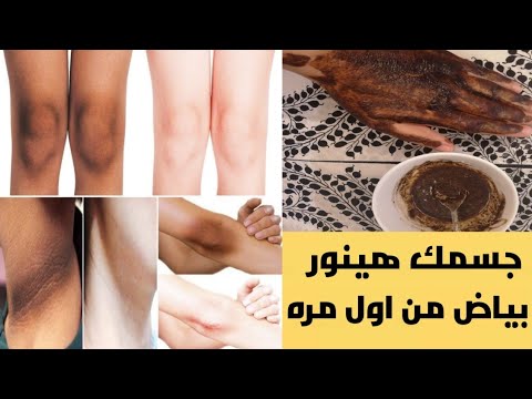 طريقة تبييض الجسم وخصوصًا القوع والأرجل