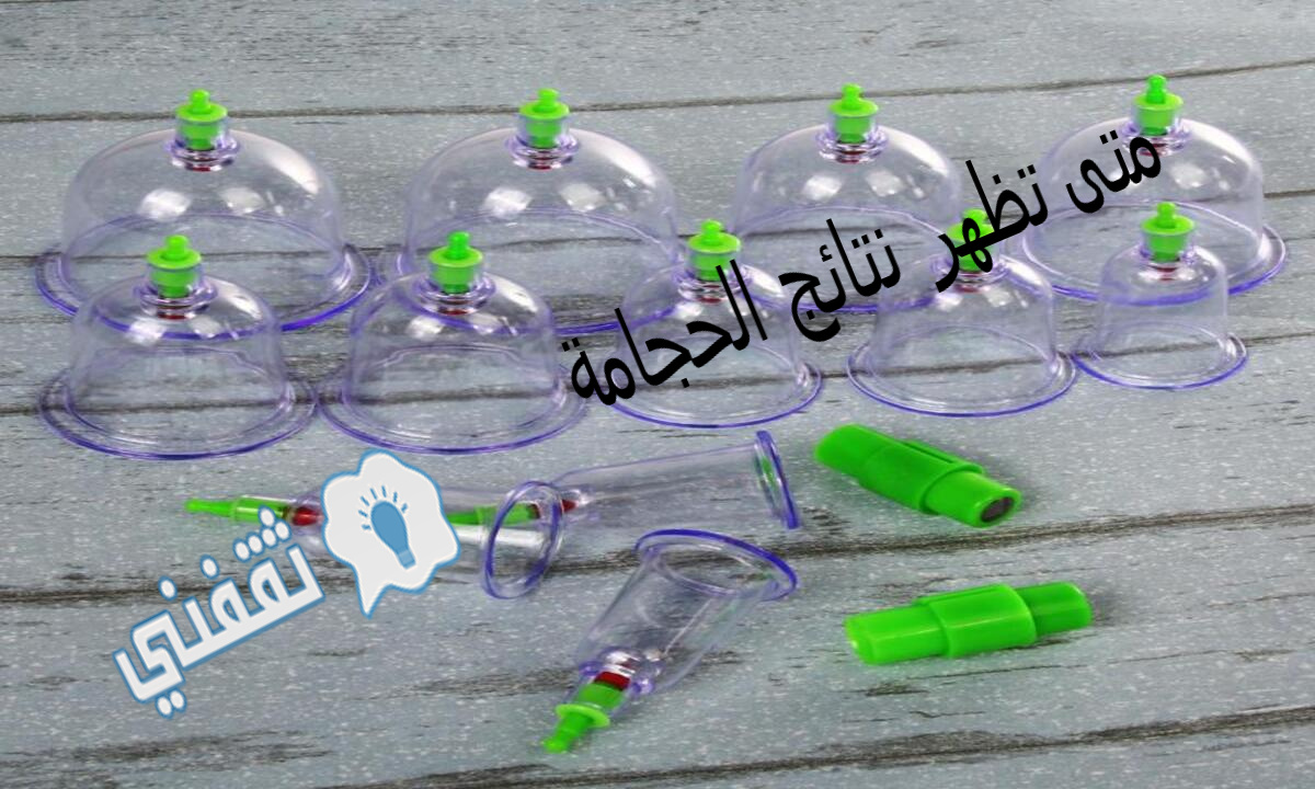 متى تظهر نتائج الحجامة