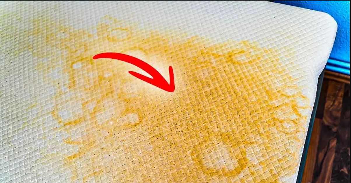 الخيوط البيضاء في البول بالصور
