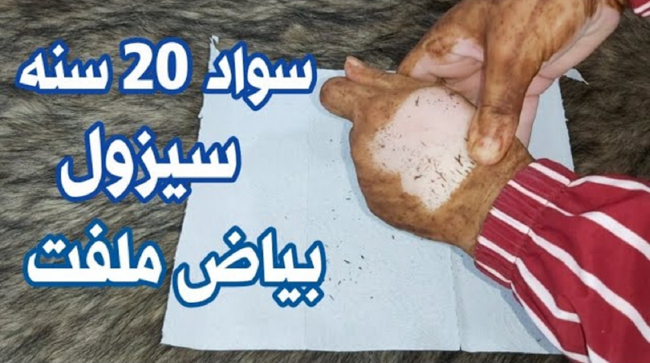 ماسك القهوة والخل السحرى سيجعلك بيضاء ولامعة