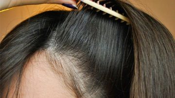 وصفة هندية لتكثيف الشعر وإنبات الفراغات في مقدمة الرأس وانسي الصلع والشعر الخفيف