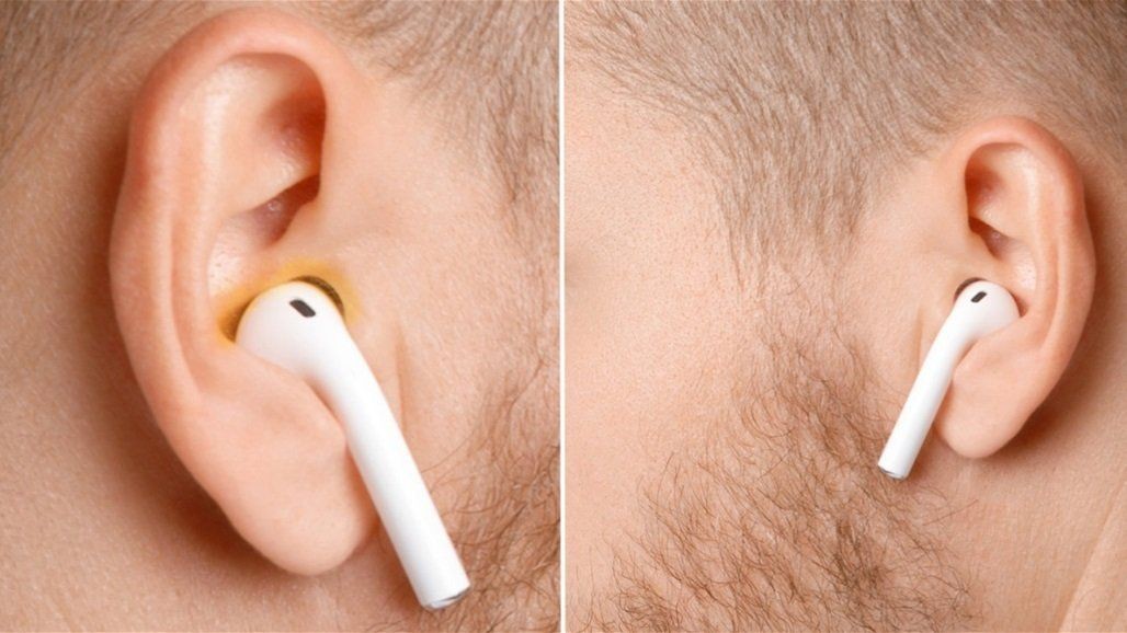 أضرار استخدام سماعات الأذن لفترة طويلة