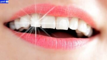 أفضل الطرق للحصول على أسنان ناصعة البياض وإزالة الجير المتراكم في دقائق
