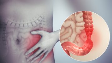 علاج القولون العصبي وتنظيفه من البقايا المتحجرة في أسبوع