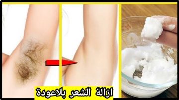خطوات إزالة الشعر الزائد بالخل وطريقة منع ظهوره مرة أخرى