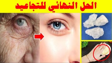 وصفة لشد تجاعيد الجبهة وحول العينين النتيجة من أول استعمال