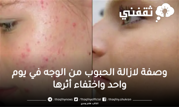 وصفة لازالة الحبوب من الوجه في يوم واحد بدون ترك أثر نهائيا بطريقة مجربة ومضمونة