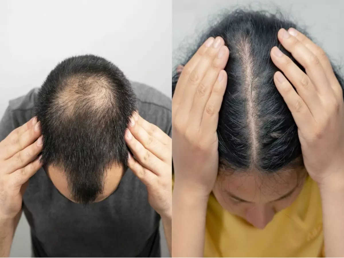 لاطلالة جذابة ومميزة.. وصفات طبيعية لتكثيف الشعر وتقويته