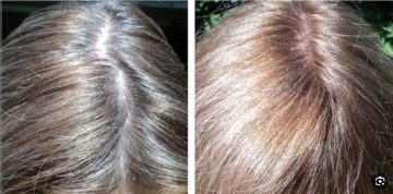 كيف تتخلص من شيب الشعر نهائيا؟ خلطة فعالة ومجربة لتغطية خصل الشعر البيضاء
