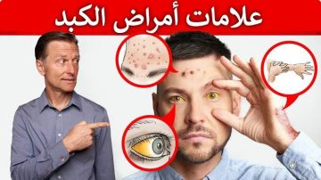 18 علامة تحذيرية في جسمك تدل على أن كبدك في خطر منها الشعور بحكة في الجلد