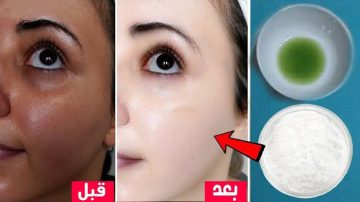 طريقة عمل كريم النشا والليمون لتبيض الوجه والجسم كله وإزالة بقع الداكنة