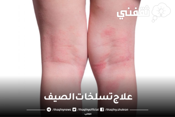 أقوي الخلطات الطبيعية الرهيبة من مطبخك لعلاج تسلخات الصيف وصفات جدتي