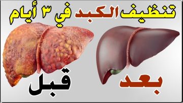 مشروب تنظيف الكبد في 3 أيام تعمل على تجديد خلايا الكبد وتقوية المناعة وطرد السموم