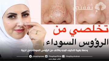 وصفة رهيبة لتنظيف الوجه والأنف من الرؤوس السوداء وعن تجربة