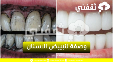 وصفة لتبييض الاسنان