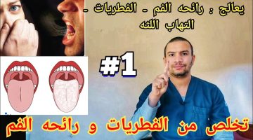 رائحة الفم الكريهة