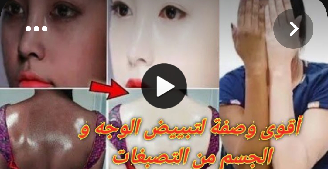 وصفة لتبييض الوجه في يوم واحد