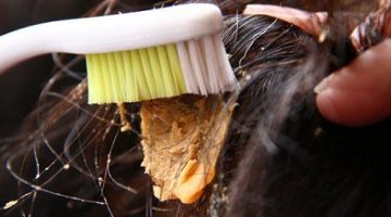 طرق سهلة وفعالة لإزالة اللبان من الشعر