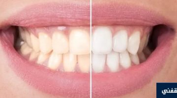 طريقة تبييض الأسنان بالليمون أو الملح في 4 دقائق واهم الأطعمة لنظافة الاسنان