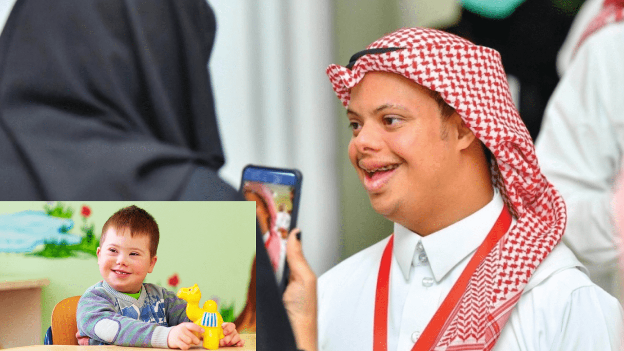 علامات متلازمة داون
