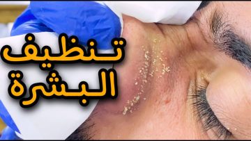 انسي انك تروحي الكوافير تاني نظفي بشرتك بنفسك وتخلصي من الجلد الميت والدهون والشوائب في دقائق