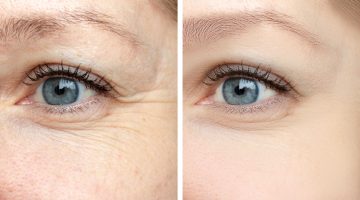 وصفة طبيعية للتخلص من ترهلات العين والوجه